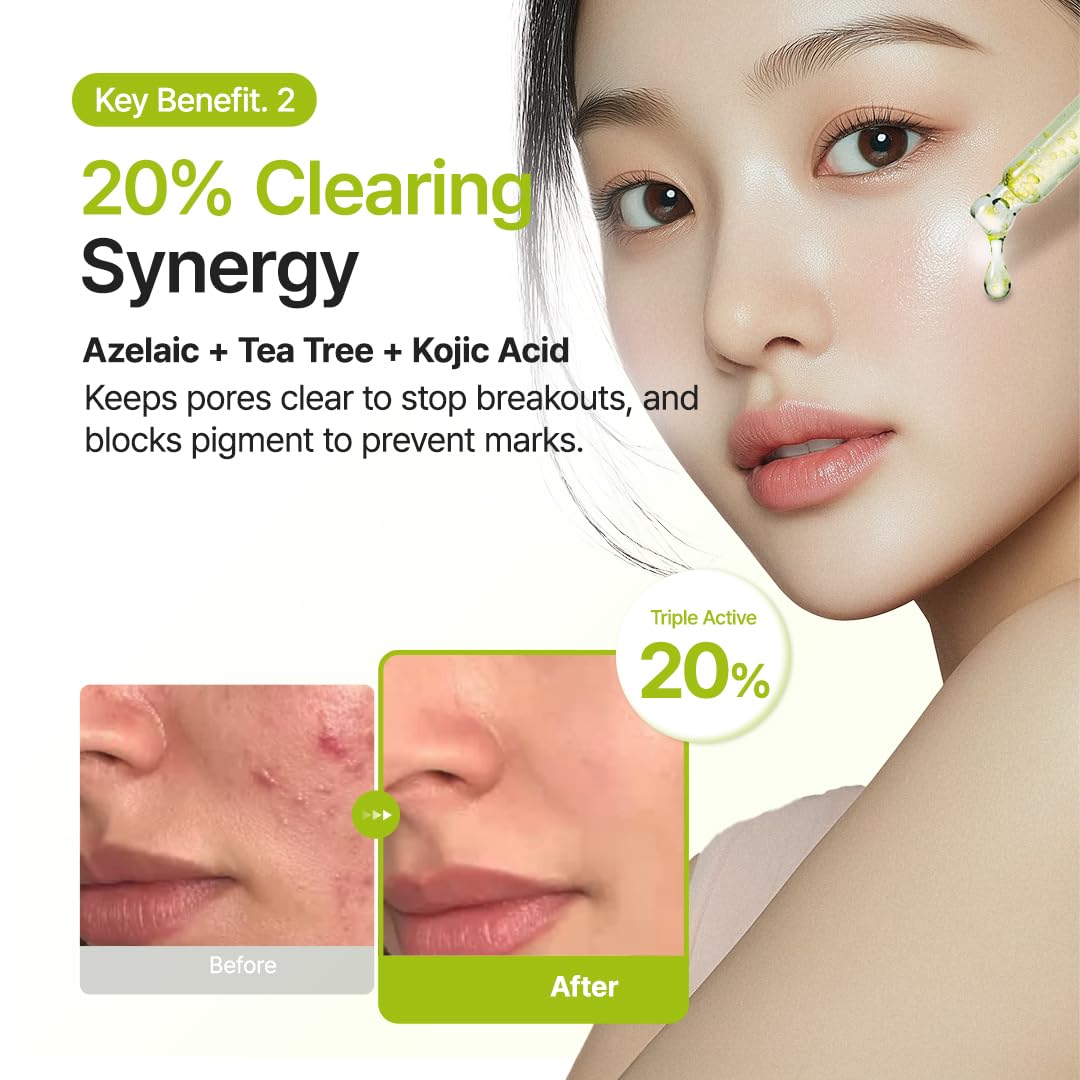 PURITO Azelaic Acid 10 Kojic Tea Tree Serum, Korean Facial Serum for Breakouts, Acne-Prone Skin, Marks, Pore Care & Even Tone, 20% Triple Active Formula with Tea Tree Capsules, 30Ml 1.01 Fl.Oz