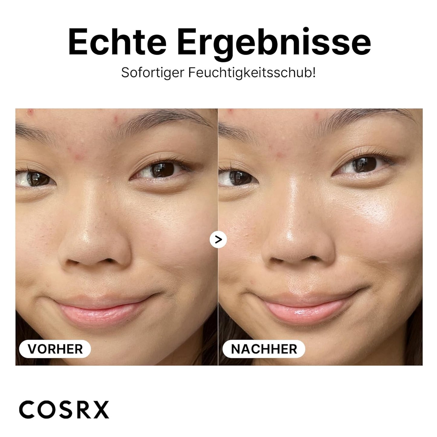 COSRX Pure Hyaluronic Acid 3% Serum, Reines Hyaluron Serum Hochdosiert - Mit Reiner Hyaluronsäure & Ceramide, anti Aging & anti Falten Feuchtigkeitspflege, Für Alle Hauttypen, Korean Skincare