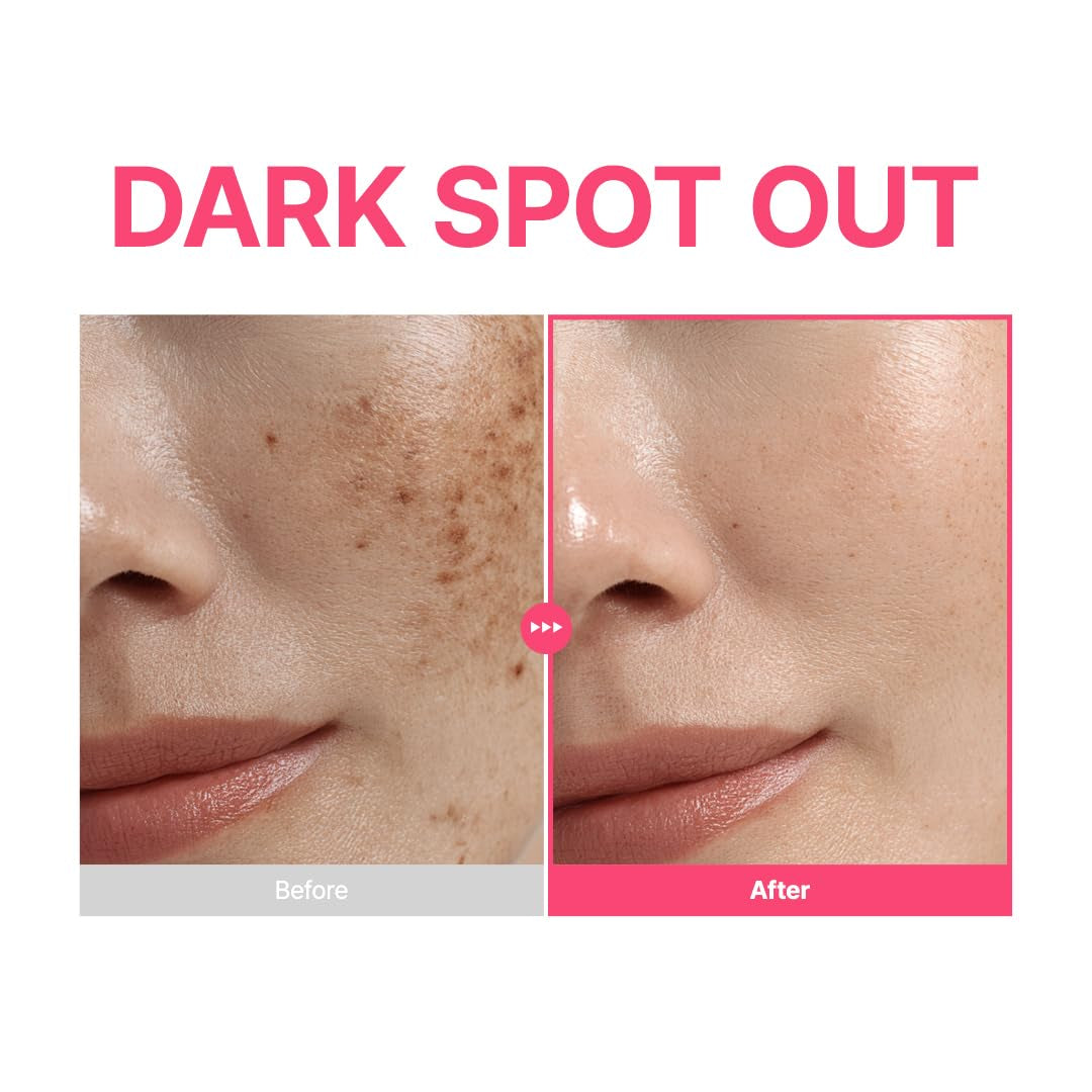 PURITO TXA 6% Niacinamide 10 Retinal Facial Serum, for Dark Spots, Post-Acne Marks, Uneven Tone & Hyperpigmentation, 16% Triple Active Formula for Clear Skin, Korean Skincare, 30Ml 1.01 Fl.Oz