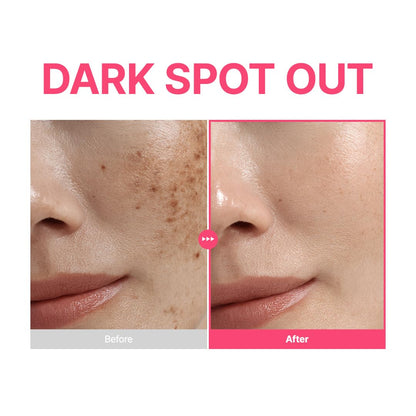 PURITO TXA 6% Niacinamide 10 Retinal Facial Serum, for Dark Spots, Post-Acne Marks, Uneven Tone & Hyperpigmentation, 16% Triple Active Formula for Clear Skin, Korean Skincare, 30Ml 1.01 Fl.Oz
